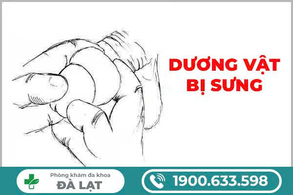 Hình ảnh minh họa